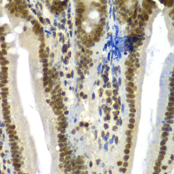 Anti-SF3B2 Antibody (CAB5875)