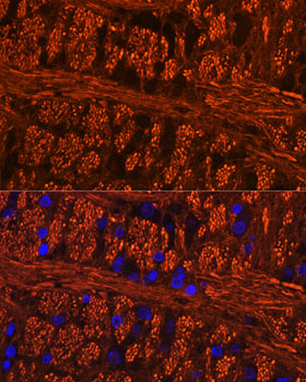 Anti-Phospho-Tau-Ser404 Antibody (CABP1100)