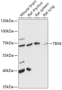 Anti-TBX6 Antibody (CAB16979)