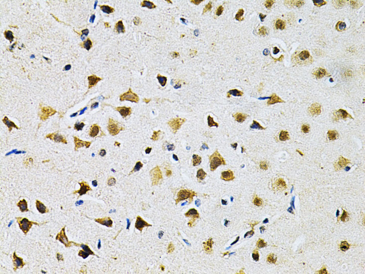 Anti-LGALS3 Antibody (CAB1464)