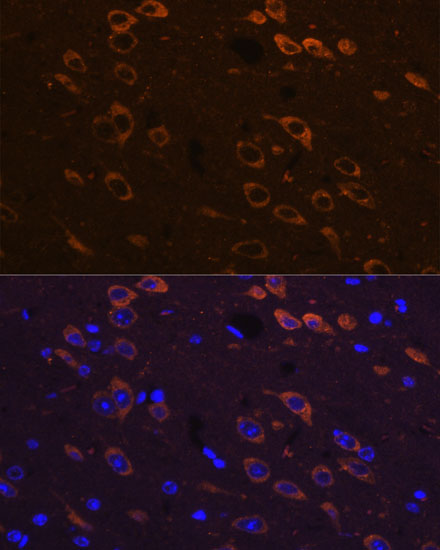 Anti-P2RY12 Antibody (CAB1710)