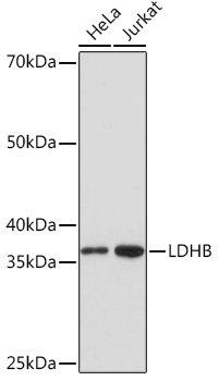 Anti-LDHB Antibody (CAB5131)
