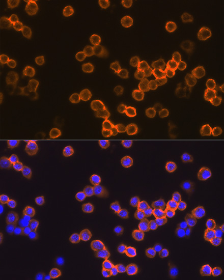 Anti-EMR1 Antibody (CAB1256)