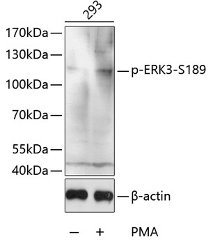 Anti-Phospho-ERK3-S189 Antibody (CABP0051)