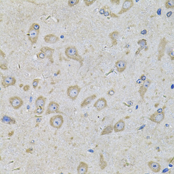 Anti-EIF3F Antibody (CAB7023)