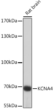 Anti-KCNA4 Antibody (CAB16390)