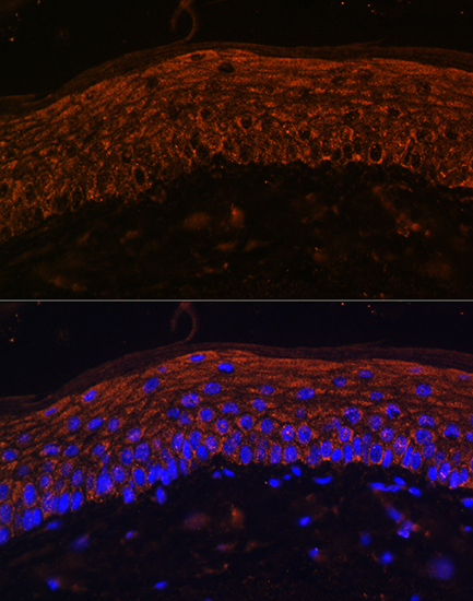 Anti-ACKR3 Antibody (CAB12712)