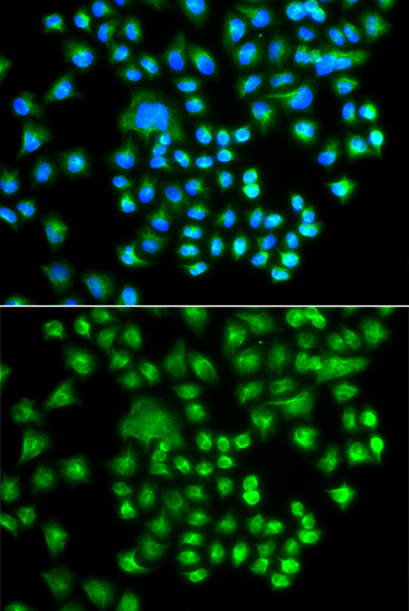 Anti-PRKACG Antibody (CAB7715)