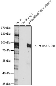 Anti-Phospho-P90RSK-S380 Antibody (CABP0562)