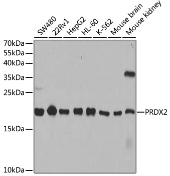 Anti-PRDX2 Antibody [KO Validated] (CAB1919)