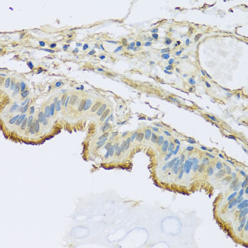 Anti-NDUFB5 Antibody (CAB14752)