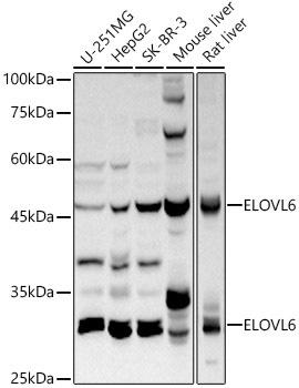 Western blot analysis of extracts of various cell lines, using ELOVL6 antibody at 1:1000 dilution. Secondary antibody: HRP Goat Anti-Rabbit IgG (H+L) at 1:10000 dilution. Lysates/proteins: 25ug per lane. Blocking buffer: 3% nonfat dry milk in TBST. Detection: ECL Basic Kit. Exposure time: 10s.