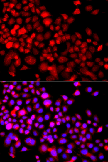 Anti-CALCOCO1 Polyclonal Antibody (CAB7987)