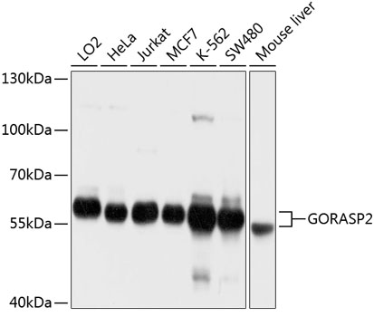 Anti-GORASP2 Antibody (CAB10383)