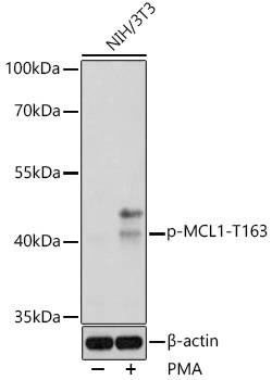 Anti-Phospho-MCL1-T163 Antibody (CABP0943)