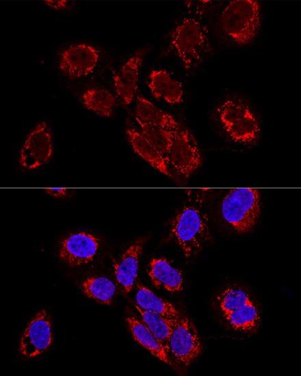 Anti-TEFM Polyclonal Antibody (CAB8511)