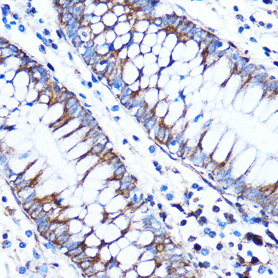 Anti-CTGF Antibody (CAB11456)