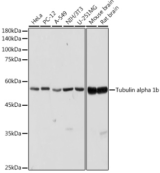 Anti-Tubulin alpha 1b Antibody (CABC025)