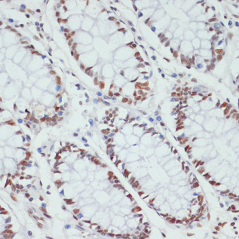 Anti-Phospho-POLR2A-S5 pAb (CABP0828)