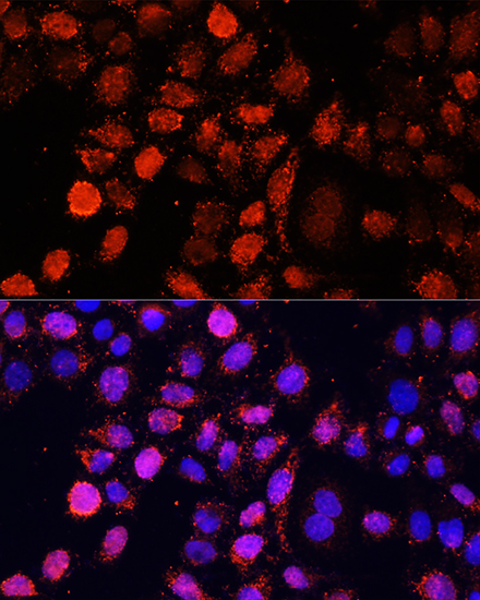 Anti-EIF4EBP1 Antibody (CAB16667)