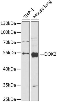 Anti-DOK2 Antibody (CAB14084)