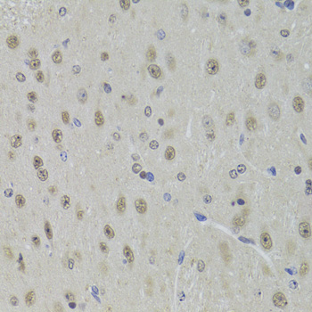 Anti-DDX1 Antibody (CAB6575)