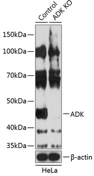 Anti-ADK Antibody [KO Validated] (CAB19992)