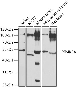 Anti-PIP4K2A Antibody (CAB7446)