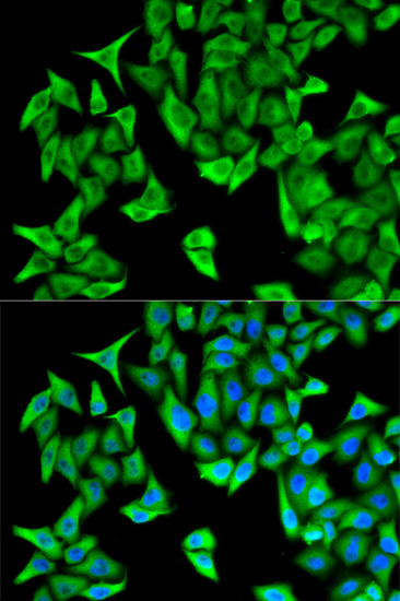 Anti-PSMD9 Antibody (CAB5357)