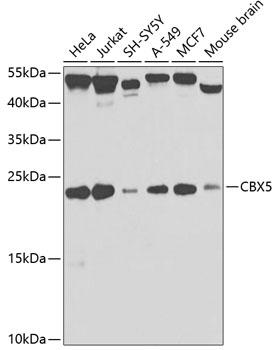 Anti-CBX5 Antibody [KO Validated] (CAB12577)