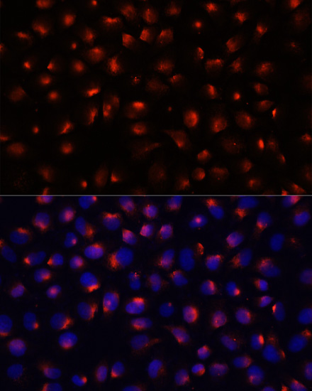 Anti-ACTN3 Antibody (CAB12797)