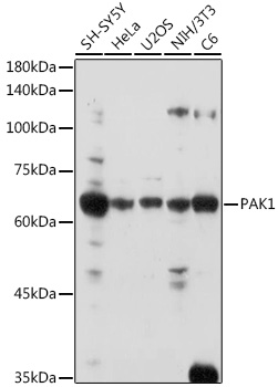 Anti-PAK1 Antibody (CAB2554)