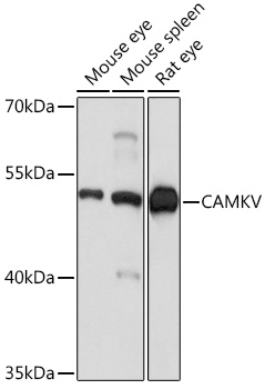 Anti-CAMKV Antibody (CAB17210)