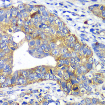 Anti-ARFGAP1 Antibody (CAB12595)