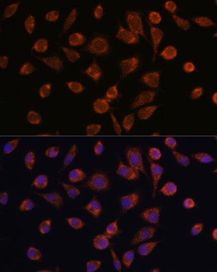 Anti-NDUFAF2 Antibody (CAB14296)