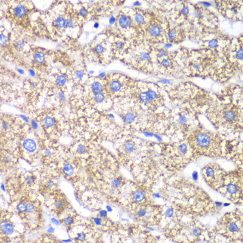 Anti-DLST Antibody (CAB13297)