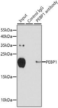 Anti-PEBP1 Antibody (CAB0578)