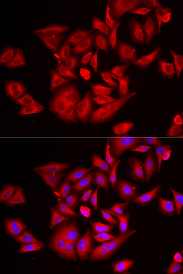 Anti-TLK2 Antibody [KO Validated] (CAB6770)