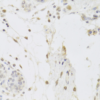 Anti-HAUSP / USP7 Antibody (CAB2345)