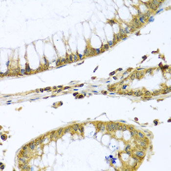 Anti-PMPCB Antibody (CAB4312)