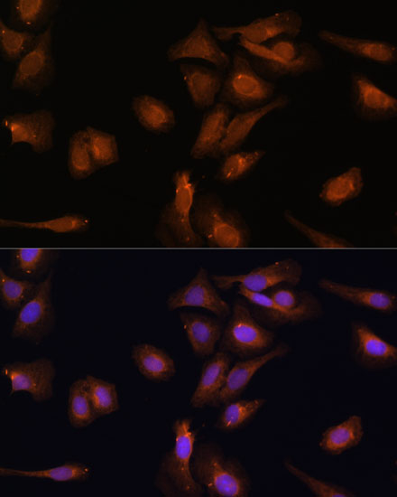 Anti-PDE6D Antibody (CAB14762)