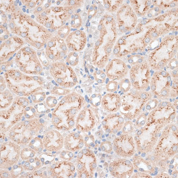 Anti-GPC3 Antibody (CAB13988)