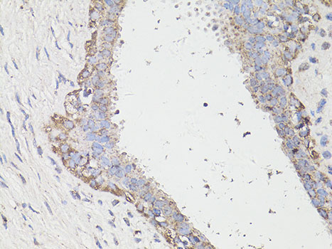 Anti-LC3A / LC3B Antibody (CAB15591)