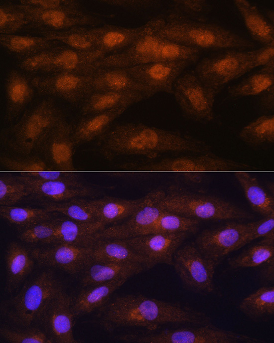 Anti-PRMT5 Antibody (CAB1520)