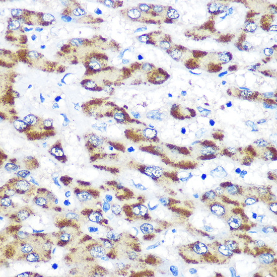 Anti-PSEN1 Antibody (CAB2187)