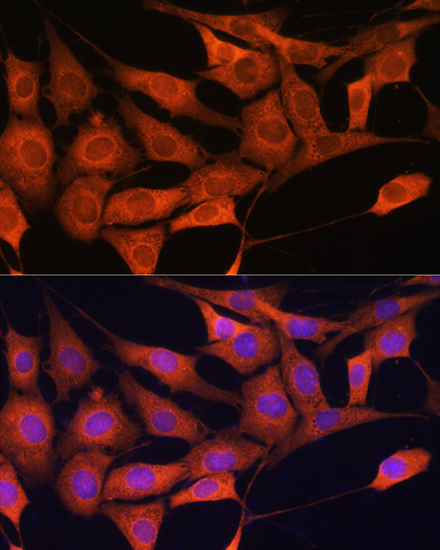 Anti-ALDOC Antibody (CAB11618)