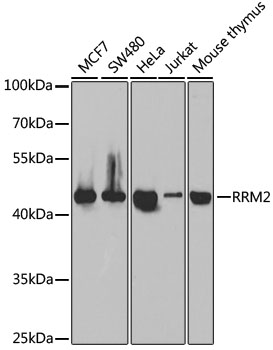 Anti-RRM2 Antibody (CAB5255)