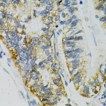 Anti-SLC27A2 Antibody (CAB1077)