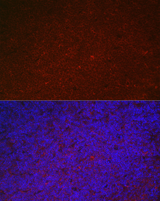 Anti-LILRB4 Antibody (CAB7073)