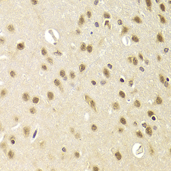 Anti-HEXIM1 Antibody (CAB5775)